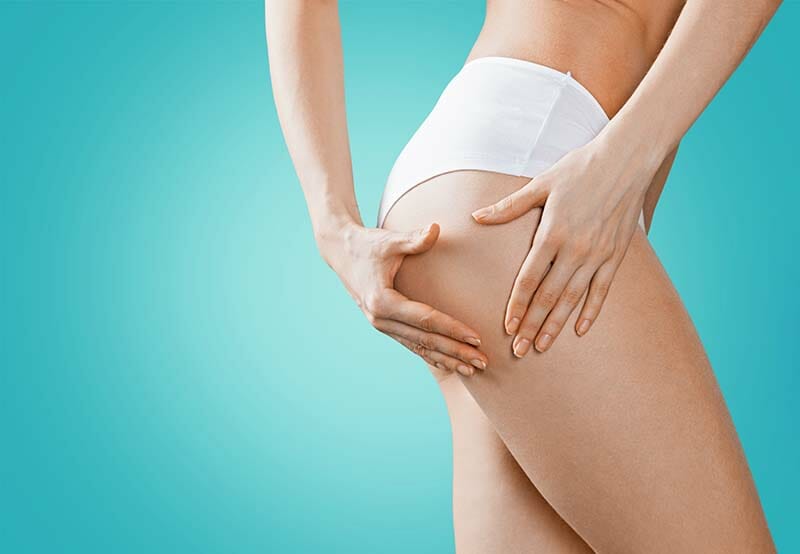 ritenzione idrica e cellulite