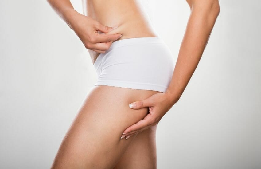 Cellulite: cos’è e quali sono le cause