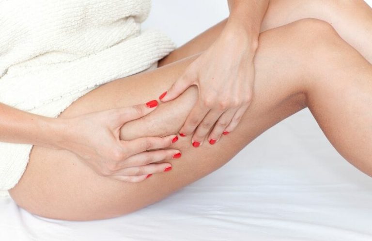 Stadi della cellulite