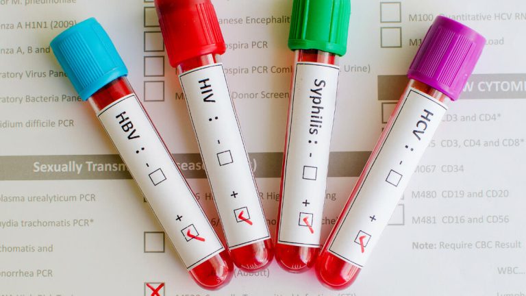 malattie-sessualmente-trasmissibili-quello-che-devi-sapere