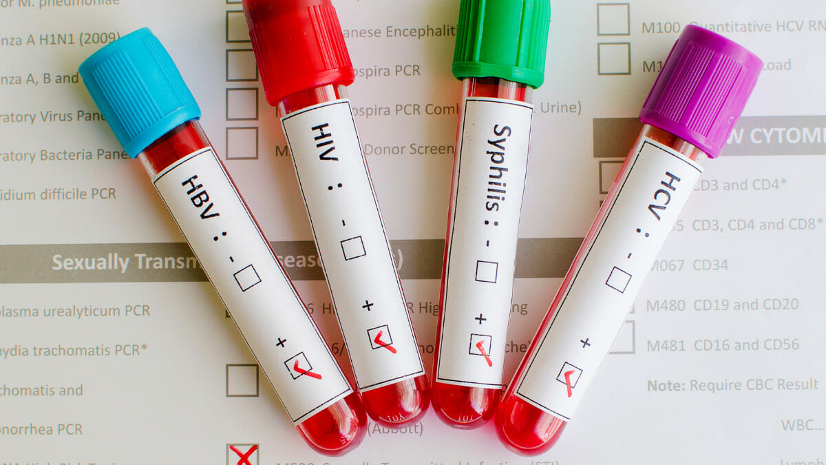 malattie-sessualmente-trasmissibili-quello-che-devi-sapere