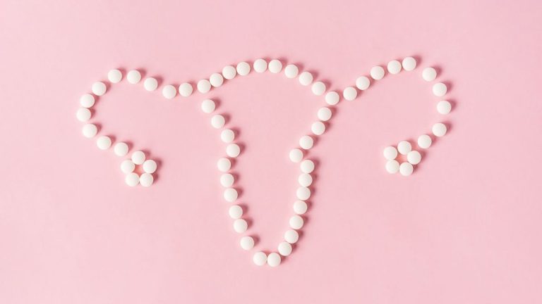 pcos e pillola contraccettiva