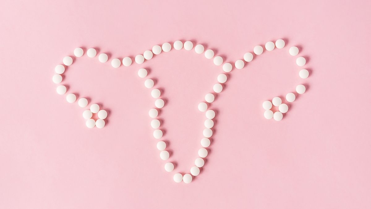 pcos e pillola contraccettiva