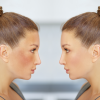 pillola e melasma
