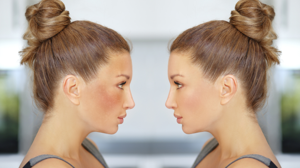 pillola e melasma