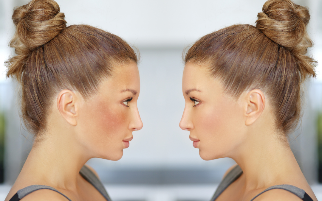 Pillola e melasma: perché compaiono le macchie in estate e cosa puoi fare per proteggere la tua pelle